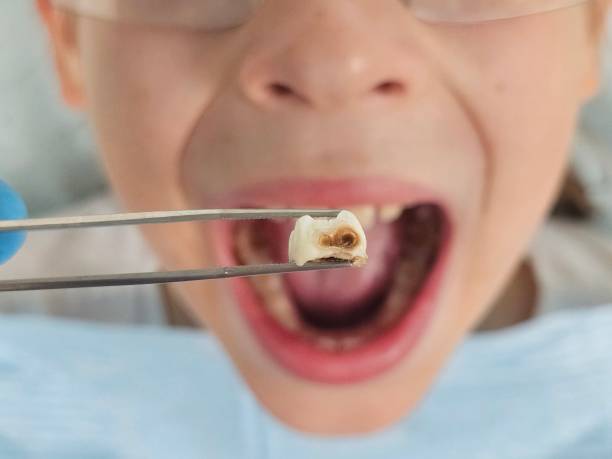 Best Pediatric Emergency Dentist in Utica, MI